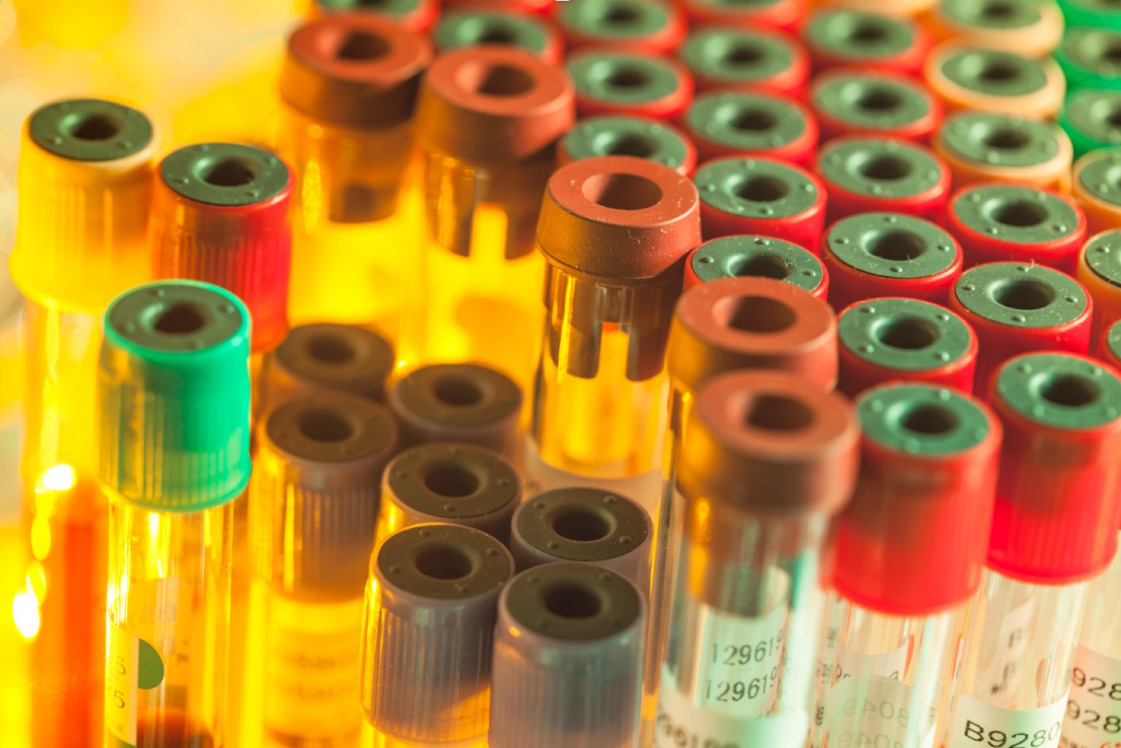 Diagnostic sample tubes representing training in molecular allergy interpretation.
