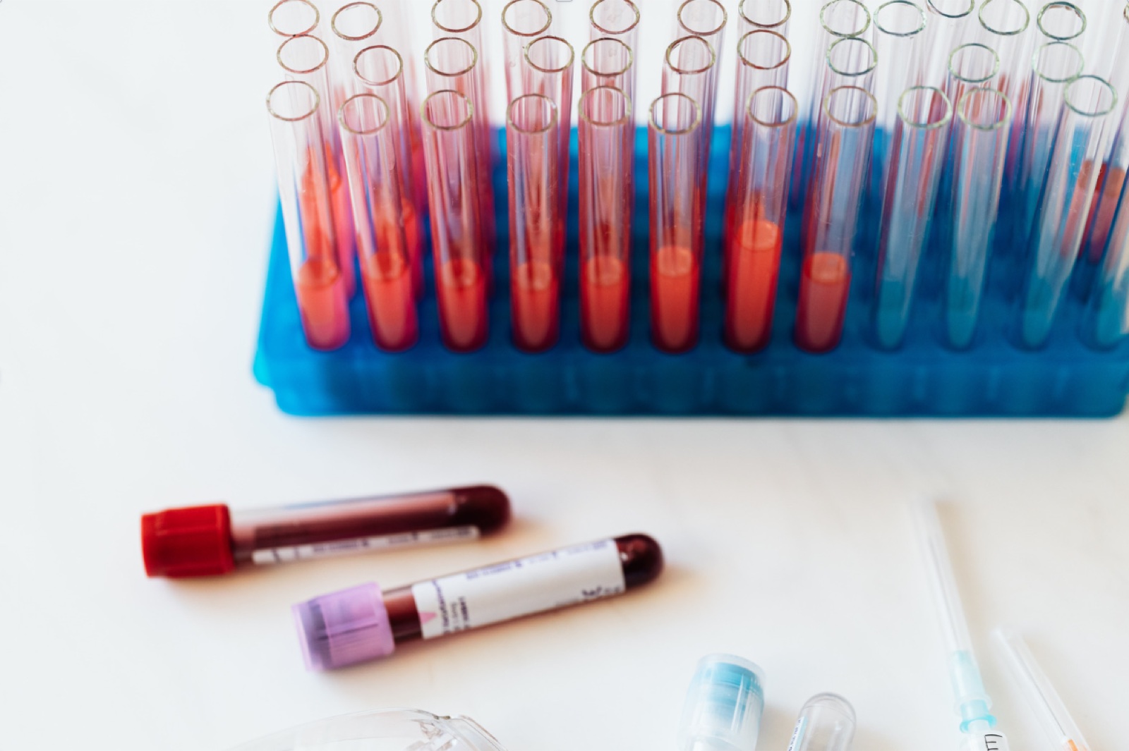 Laboratory tubes representing allergy diagnostics and clinical translation.